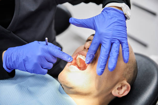 Best Emergency Dental Extractions in Homer, MI