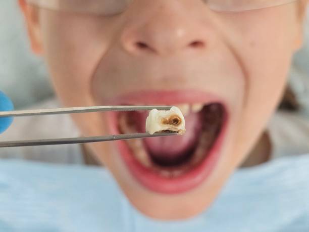 Best Emergency Dentist for Special Needs Patients in Homer, MI
