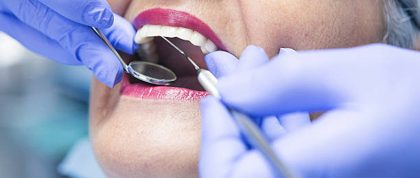 Best Broken or Cracked Tooth Emergency Dentist in Homer, MI